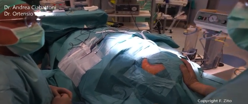 Impiantato all’ospedale Mazzoni <br> il primo orecchio bionico <br> <span> (Foto e video) </span>