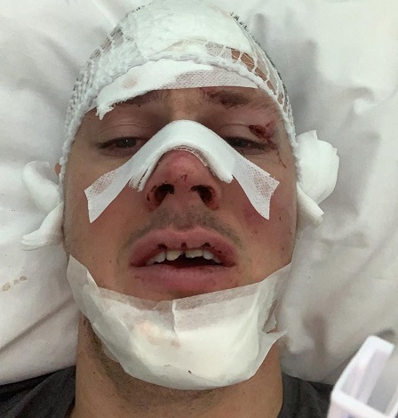 Spaventoso incidente stradale, <br> Ninkovic ricoverato in ospedale