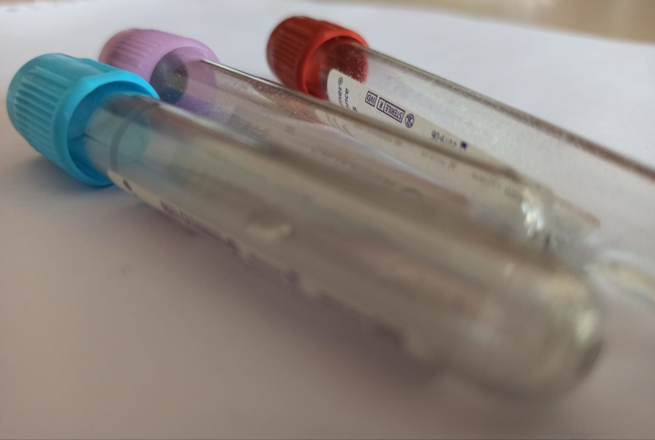 Emergenza Coronavirus: <br> i nuovi casi nelle Marche sono 351, <br> di cui 41 in provincia di Ascoli